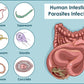 Parasite Detox Cleanse